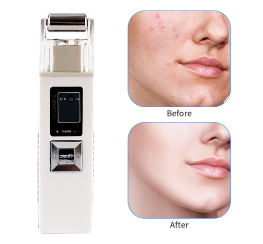 Galvanic Microcurrent Facial Skin Firming Whiting Machine Iontophoresis Acne Pore Blackhead Removal Massager Skin Care Therapy