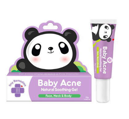 Tiny Buds Baby Acne Natural Soothing Gel 20g
