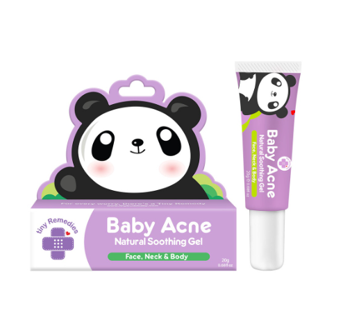 Tiny Buds Baby Acne Soothing gel