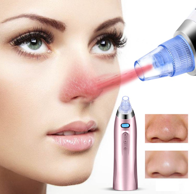 Blackhead Skin Care Face Deep Pore Acne Pimple Removal Vacuum Suction Facial