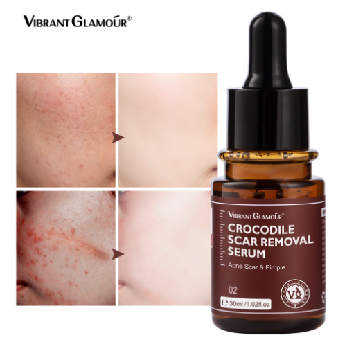 VIBRANT GLAMOUR Crocodile Scar Repair Serum Ceramides Face Essence Visibly Reduce the Look of Scars Dark Spots Wrinkles Anti-Acne