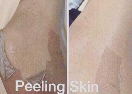 COD peeling lotion ( orange Peel lotion )